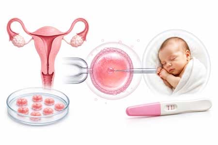 IVF & Fertility