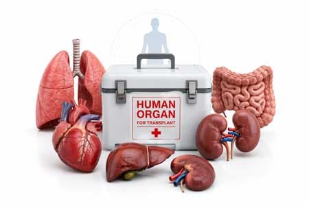 Organ Transplant